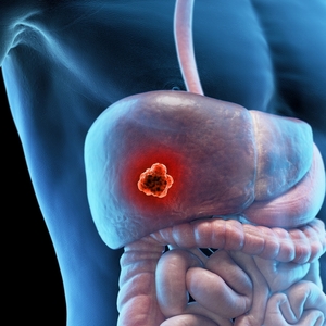 9 Ways to Lower and Manage Cortisol Levels