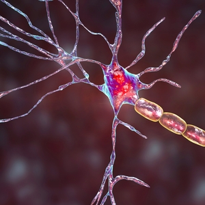 9 Ways to Lower and Manage Cortisol Levels