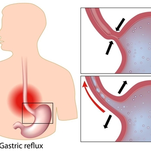 9 Ways to Lower and Manage Cortisol Levels