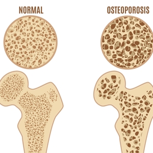 9 Ways to Lower and Manage Cortisol Levels