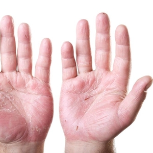 9 Ways to Lower and Manage Cortisol Levels