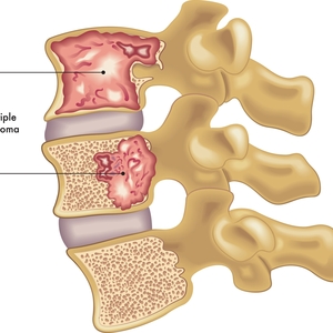 9 Ways to Lower and Manage Cortisol Levels