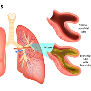 9 Ways to Lower and Manage Cortisol Levels