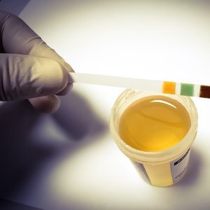 9 Ways to Lower and Manage Cortisol Levels