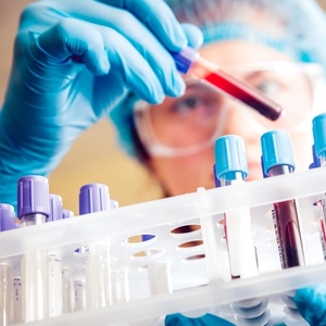 9 Ways to Lower and Manage Cortisol Levels