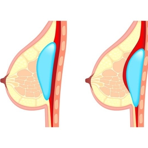 9 Ways to Lower and Manage Cortisol Levels
